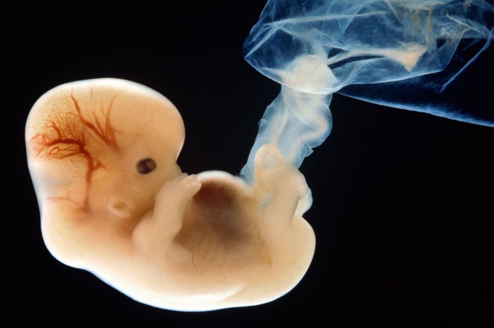 Six-week-old-human-embryo.jpg